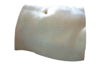 腹部切开缝合训练模型