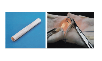 肠管吻合模型(20mm)